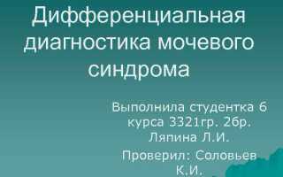 Дифференциальная диагностика мочевого синдрома презентация