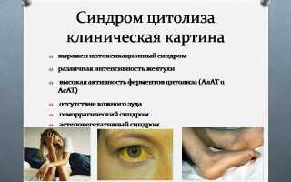 Для синдрома цитолиза характерно повышение в крови
