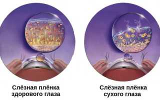 Что делать при синдроме сухих глаз