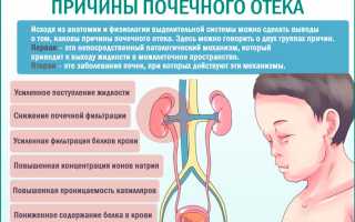 Отечный синдром при почечных заболеваниях