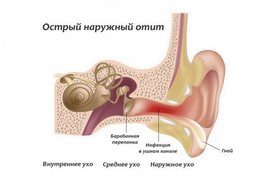 Сустав нижней челюсти воспаление синдром