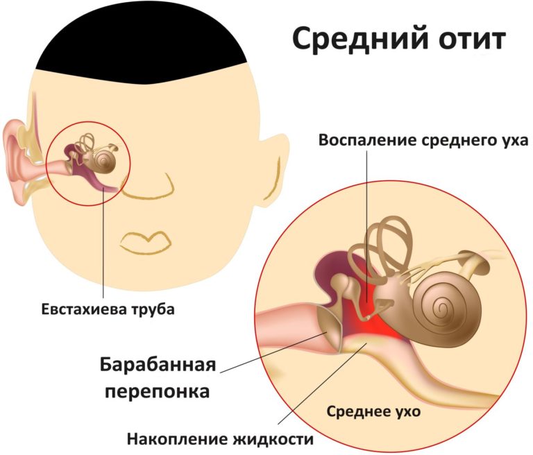 Синдром височно нижнечелюстного сустава лечение