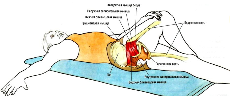 Лечение синдрома грушевидной в домашних