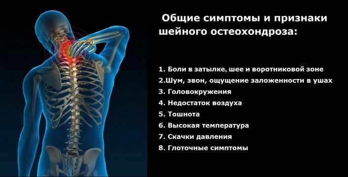Что может неметь при остеохондрозе с корешковым синдромом