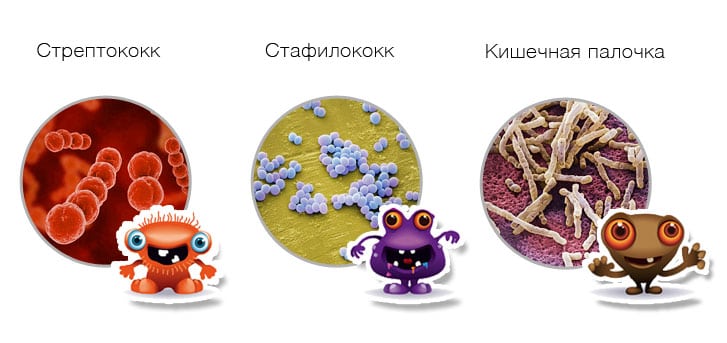 Сустав нижней челюсти воспаление синдром