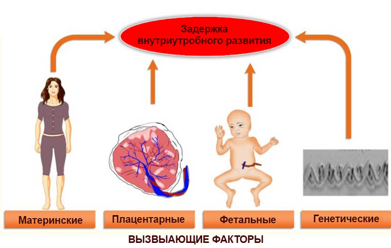 Факторы риска задержки внутриутробного развития