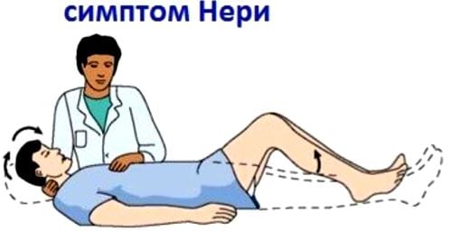 Что может неметь при остеохондрозе с корешковым синдромом