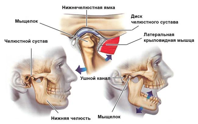 Синдром височно нижнечелюстного сустава лечение